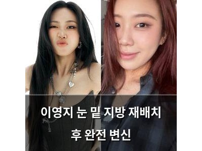 이영지 눈 밑 지방 재배치 후 완전 변신 썸네일