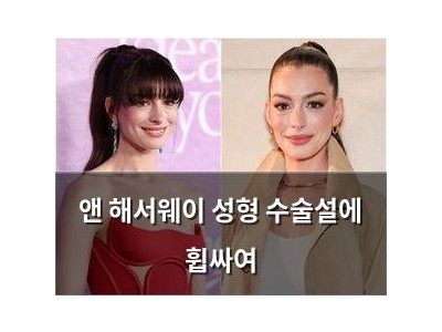 앤 해서웨이 성형 수술설에 휩싸여 썸네일